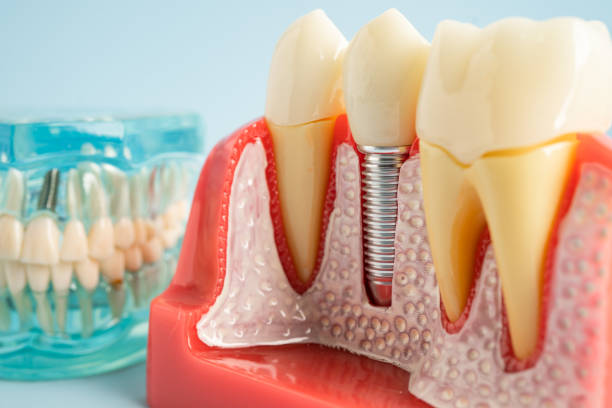 Professional  Dental Services in Wheatland, WY